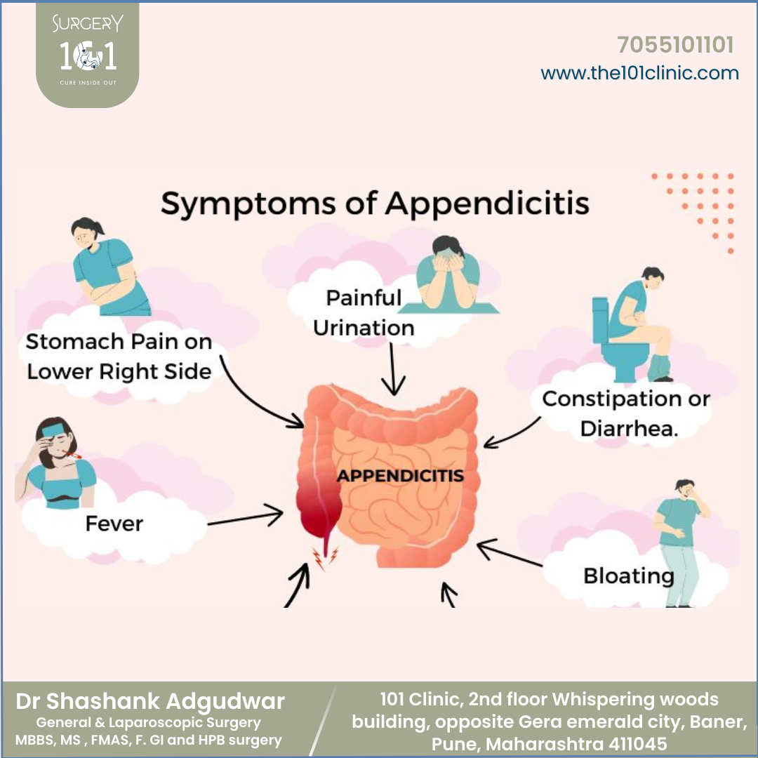 What Is Appendicitis And Symptoms Of Appendicitis