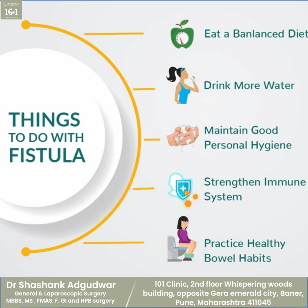 Complex Fistula